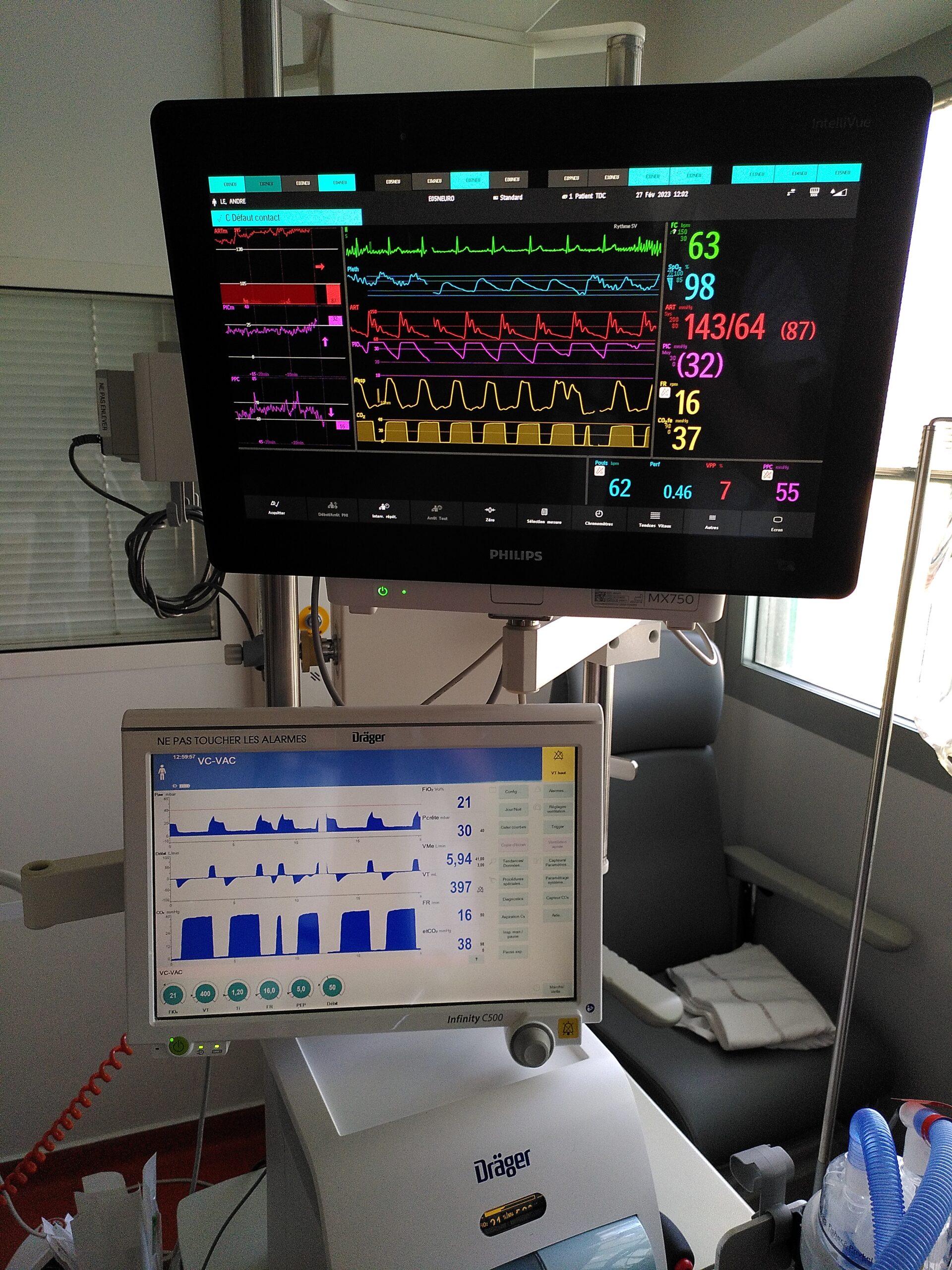 neuro-ophtamologie